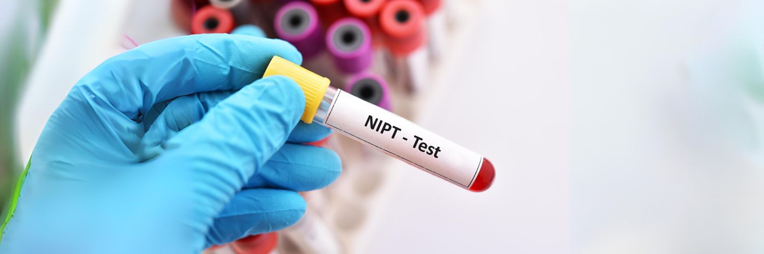 בדיקת NIPT לנשים בהריון